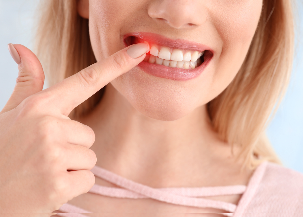 Gum Disease Boca Raton FL
