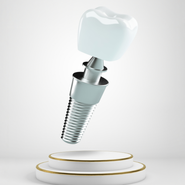 Boca Raton Implant Dentist
