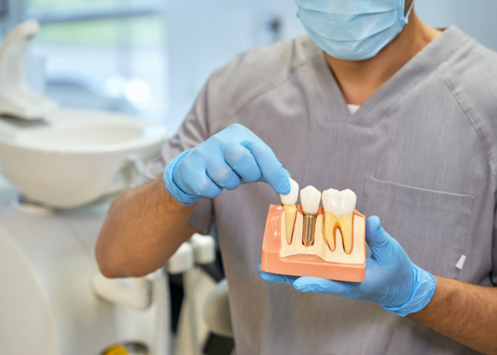 Dental Implants Boca Raton Fl