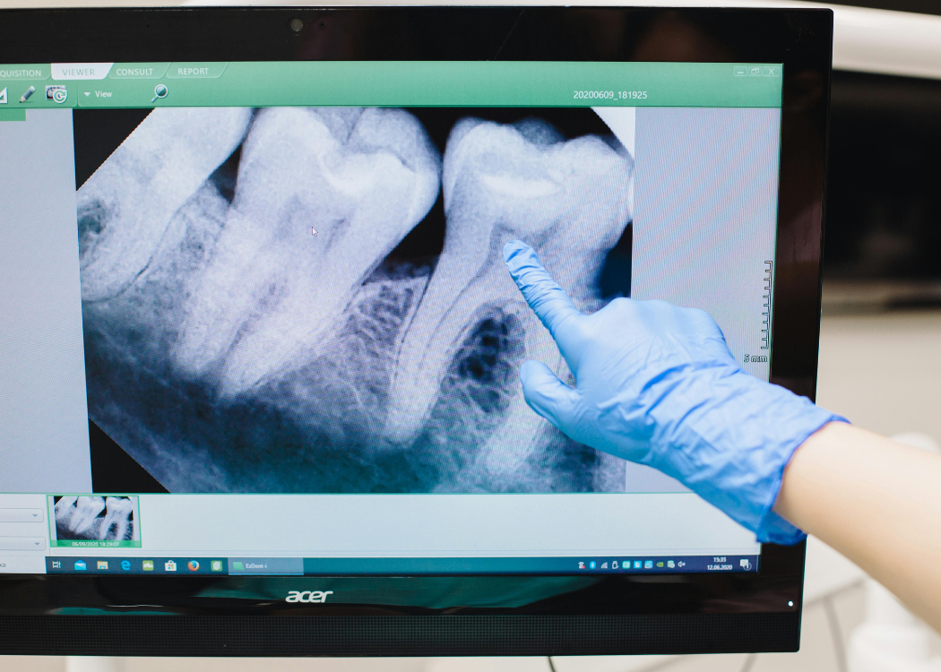 Oral Surgery FL