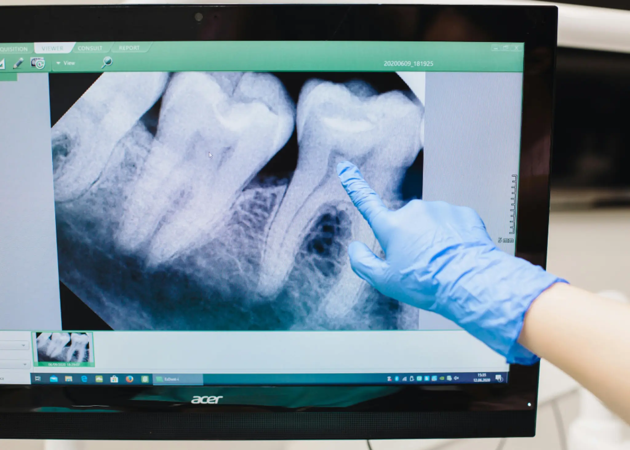 Boca Raton, FL Oral Surgery