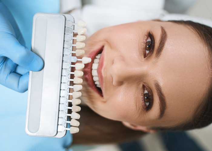 Porcelain Dental Veneers Boca Raton