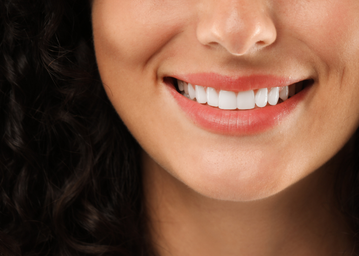 Dental Veneers Boca Raton Fl